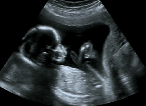 ecografia-feto-gravidanza-shutterstock_140518024