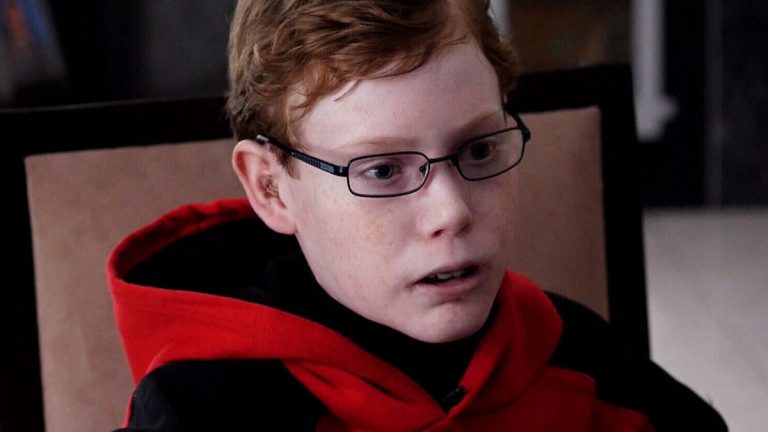 Jonathan, 14 anni, la pelle fragile come ali di farfalla. «Soffro anche quando dormo, ma non sono solo»