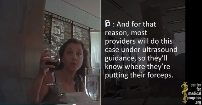 planned-parenthood-organi-aborto-video