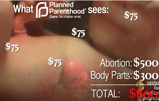 planned-parenthood-video