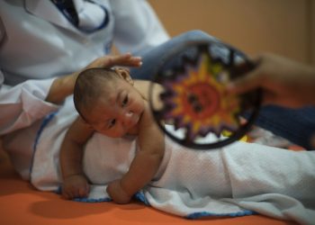 FILE - In this Jan. 28, 2016, file photo, three-month-old Daniel, who was born with microcephaly, undergoes physical therapy at the Altino Ventura foundation in Recife, Brazil. The mosquito behind the Zika virus seems to operate like a heat-driven missile of disease. Scientists say the hotter it gets, the better the mosquito that carries Zika virus is at transmitting a variety of dangerous illnesses. (ANSA/AP Photo/Felipe Dana, File)