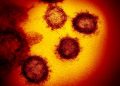 Immagine al microscopio del coronavirus Sars-Cov-2