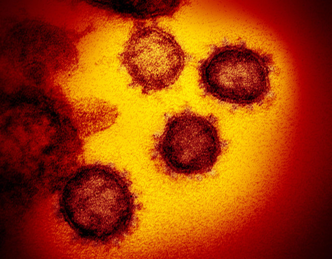 Immagine al microscopio del coronavirus Sars-Cov-2