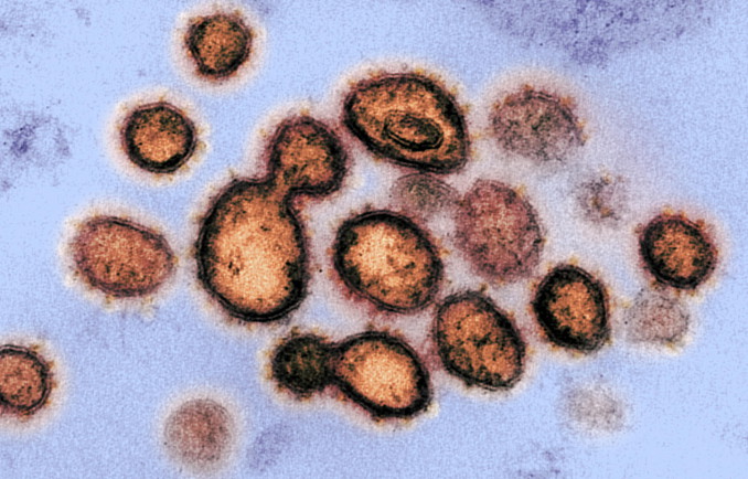 Il coronavirus responsabile del Covid-19 fotografato al microscopio