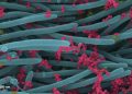 Immagine al microscopio di cellule umane invase dal coronavirus