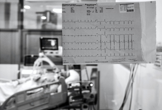 Elettrocardiogramma in reparto di ospedale