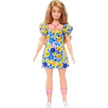 Barbie sindrome di Down