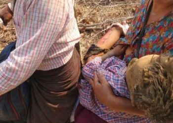 Un bambino rimasto ferito dopo l'attacco del regime al villaggio di Pazigyi