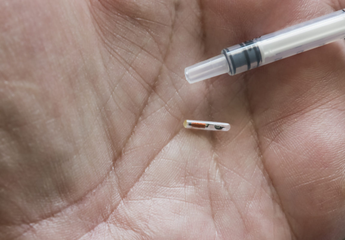 Microchip