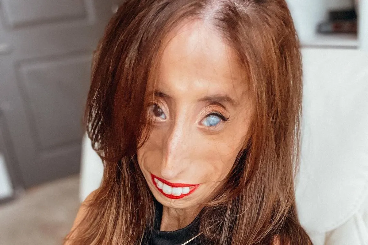 Il sogno di Lizzie Velásquez, “la ragazza più brutta del mondo” Tempi