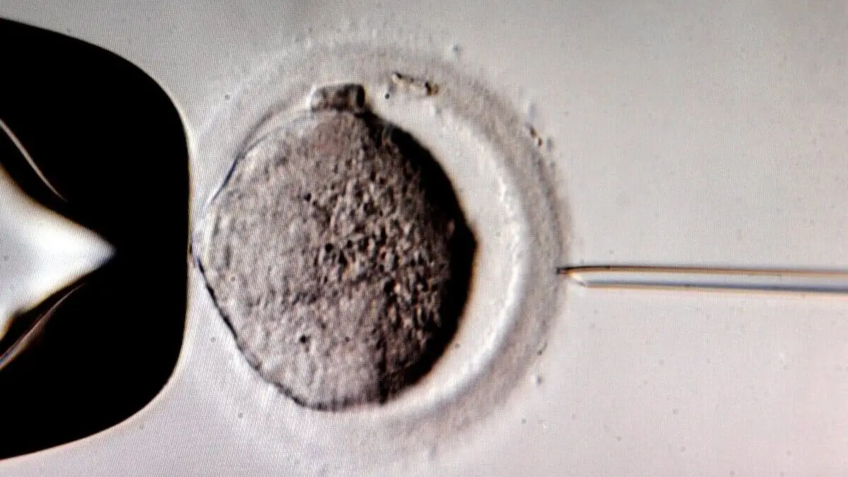 Un monitor mostra la microiniezione dello sperma in una cellula uovo utilizzando un microscopio presso la clinica di fecondazione in vitro