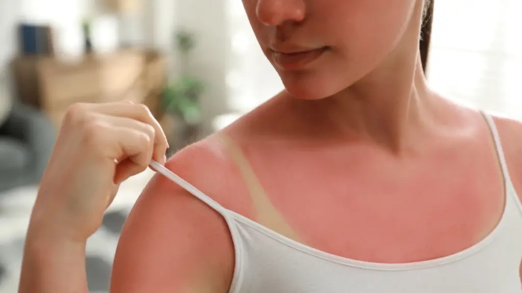 Conseguenze del tanmaxxing